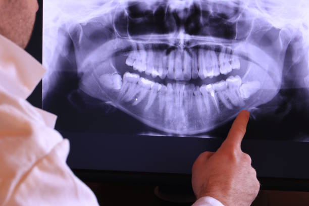 Best Emergency Dental Care for Trauma or Injury in St Paul, TX